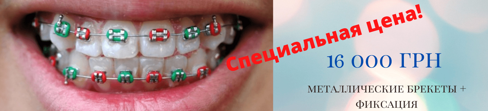 banner-breket-ru-07