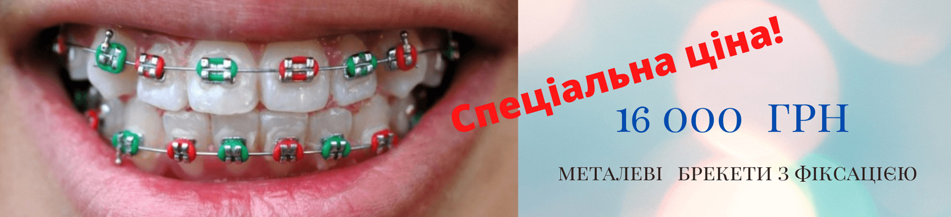 banner-breket-ua-07-1