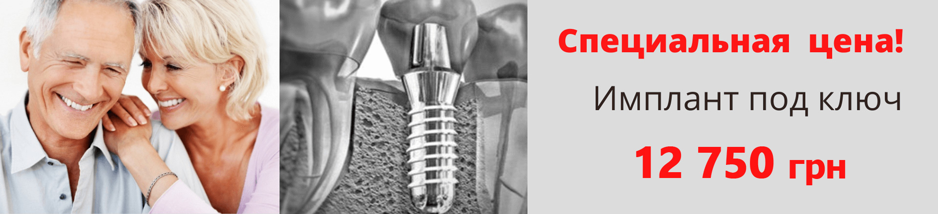 banner-implant-ru-07